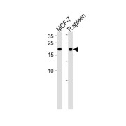 WB analysis of MCF-7 cell line lysates and rat spleen tissue lysates.