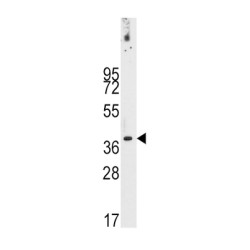 Pyruvate Dehydrogenase Complex Component X (PDHX) Antibody