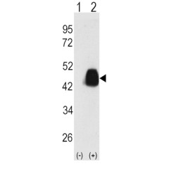 Pyruvate Dehydrogenase Complex Component X (PDHX) Antibody