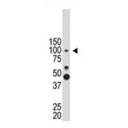 Prospero Homeobox 1 (PROX1) Antibody