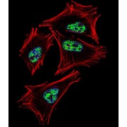 Prospero Homeobox 1 (PROX1) Antibody