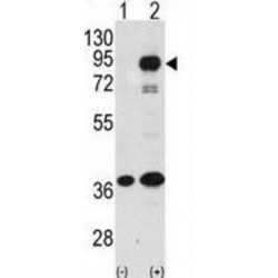 Prospero Homeobox 1 (PROX1) Antibody