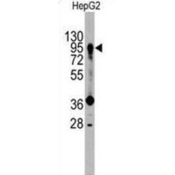 Prospero Homeobox 1 (PROX1) Antibody