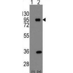 Prospero Homeobox 1 (PROX1) Antibody