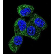 Microtubule-Associated Protein Tau (MAPT) Antibody