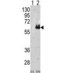 Microtubule-Associated Protein Tau (MAPT) Antibody