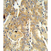 Vascular Endothelial Growth Factor C (VEGFC) Antibody