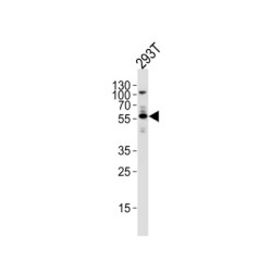 Vascular Endothelial Growth Factor C (VEGFC) Antibody