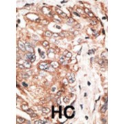 Restricted Expression Proliferation-Associated Protein 100 (P100) Antibody