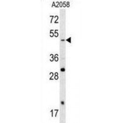 Transcription Factor SOX-4 (SOX4) Antibody
