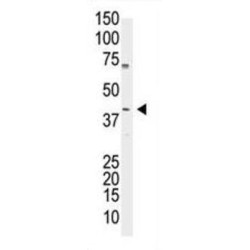 POU Class 5 Homeobox 1 / OCT4 (POU5F1) Antibody