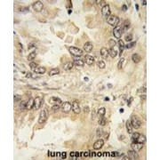 Transcription Factor SOX-2 (SOX2) Antibody