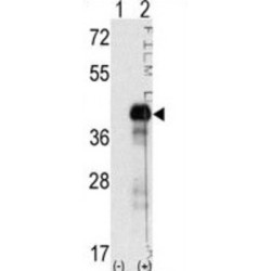 Transcription Factor SOX-2 (SOX2) Antibody