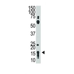 Thy-1 Membrane Glycoprotein (THY1) Antibody