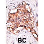 Growth Differentiation Factor 3 (GDF3) Antibody