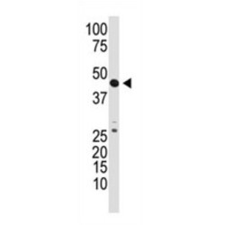 Growth Differentiation Factor 3 (GDF3) Antibody