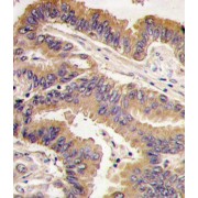 Growth Differentiation Factor 5 (GDF5) Antibody