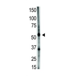 Growth Differentiation Factor 5 (GDF5) Antibody