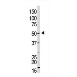 Growth Differentiation Factor 9 (GDF9) Antibody