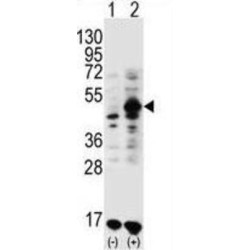 Growth Differentiation Factor 9 (GDF9) Antibody