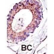 Ubiquitin Conjugation Factor E4 A (UBE4A) Antibody