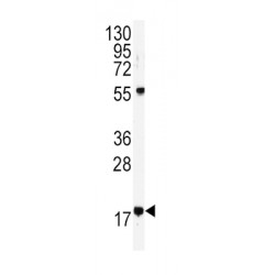 Ubiquitin-Conjugating Enzyme E2 D1 (UBE2D1) Antibody