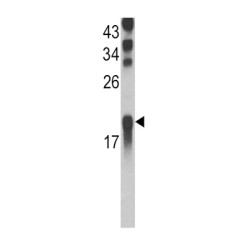 Ubiquitin-Conjugating Enzyme E2 L3 (UBE2L3) Antibody