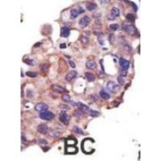 Ubiquitin-Conjugating Enzyme E2 L3 (UBE2L3) Antibody