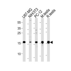 Ubiquitin-Conjugating Enzyme E2 L3 (UBE2L3) Antibody