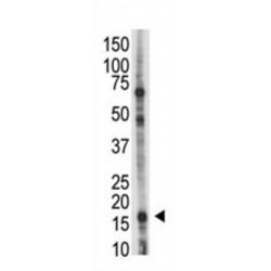 Ubiquitin/ISG15-Conjugating Enzyme E2 L6 (UBE2L6) Antibody