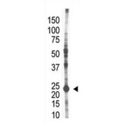 E2EPF Antibody