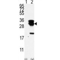 E2EPF Antibody