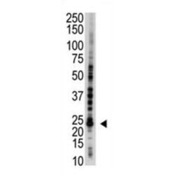 E2EPF Antibody