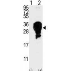 E2EPF Antibody