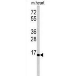 Ubiquitin-Conjugating Enzyme E2 G1 (UBE2G1) Antibody