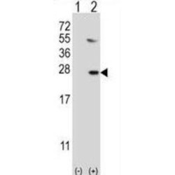 Ubiquitin-Conjugating Enzyme E2 G1 (UBE2G1) Antibody