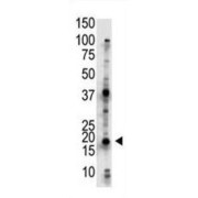 Ubiquitin-Conjugating Enzyme E2 G2 (UBE2G2) Antibody