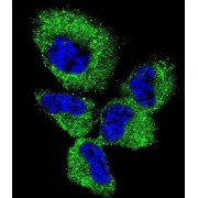 Ubiquitin Carboxyl Terminal Hydrolase L1 (UCHL1) Antibody