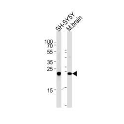 Ubiquitin Carboxyl Terminal Hydrolase L1 (UCHL1) Antibody