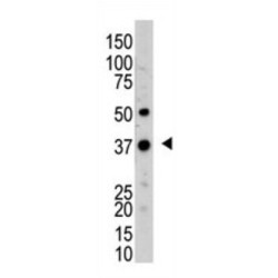 Ubiquitin C-Terminal Hydrolase UCH37 (UCH37) Antibody