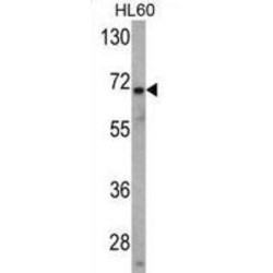 Ubiquitin Carboxyl-Terminal Hydrolase 2 (USP2) Antibody