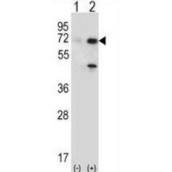 Ubiquitin Carboxyl-Terminal Hydrolase 2 (USP2) Antibody