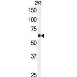 Ubiquitin Carboxyl-Terminal Hydrolase 3 (USP3) Antibody