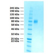 SDS-PAGE analysis of recombinant Human Fibroblast Growth Factor Receptor 2 (FGFR2c) Protein.