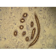 IHC-P analysis of CK16 expressed in the luminal cells of the sweat glands of the human skin (4 µm section).