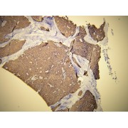 IHC-P analysis of epithelial thymoma tissue (4 µm section).