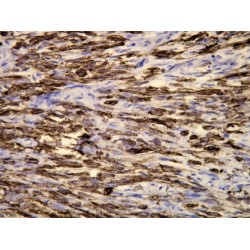 Keratin, Type I Cytoskeletal 19 (KRT19) Antibody