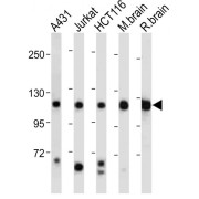 WB analysis of A431 whole cell lysate, Jurkat whole cell lysate, HCT116 whole cell lysate, Mouse brain tissue lysate, and Rat brain tissue lysate, using PI3KCA antibody (1/2000 dilution). Predicted band size: 124 kDa.