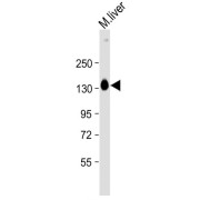 WB analysis of mouse liver lysate, using SASH1 antibody (1/2000 dilution).