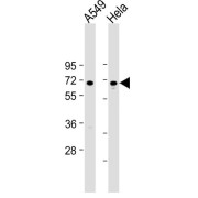 WB analysis of A549 and HeLa cells, using FOXN1 antibody (1/2000 dilution). Predicted band size: 69 kDa. Blocking/Dilution buffer: 5% NFDM/TBST.